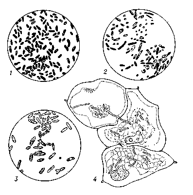 Азотфиксирующие микроорганизмы: 1 — Azotobacter vinelandii; 2 — Clostridium pasterianum; 3 — Rhizobium meliloti; 4 — клубеньковые бактерии в клетках корня ольхи.
