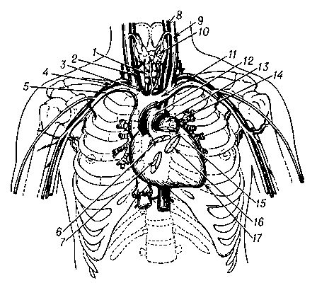 Рис. 1. Проекция сердца, створок и крупных сосудов на переднюю стенку грудной клетки (полусхематично): 1 — трахея; 2 — правая общая сонная артерия; 3 — плечеголовной ствол; 4 — подключичная артерия; 5 — подключичная вена; 6 — отверстие аорты (полулунные клапаны аорты); 7 — правое предсердно-желудочковое отверстие (трёхстворчатый клапан); 8 — наружная сонная артерия; 9 — внутренняя ярёмная вена; 10 — щитовидная железа; 11 — левая плечеголовная вена; 12 — дуга аорты; 13 — лёгочный ствол; 14 — бронхи; 15 — отверстие лёгочного ствола (клапан лёгочной артерии); 16 — левое предсердно-желудочковое отверстие (митральный клапан); 17 — верхушка сердца.