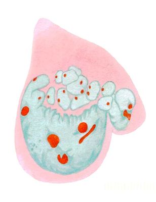 Клеточные ядра на окрашенных препаратах: фрагментация гигантского полиплоидного ядра трофобласта крысы, окраска метиловым зеленым — пиронином (хроматин зеленый, ядрышки красные, цитоплазма розовая).