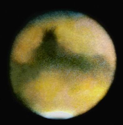 6. Марс по наблюдениям с Земли в противостоянии 1971 между 7 июля и 3 сентября (в хронологическом порядке).