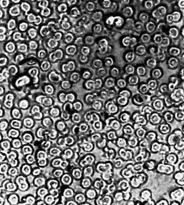 Рис. 5а. Красные кровяные тельца, полученные оптическим микроскопом.