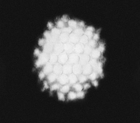 Рис. 3г. Биообъекты с совершенной точечной симметрией. Радиолярии: частица аденовируса в форме икосаэдра.