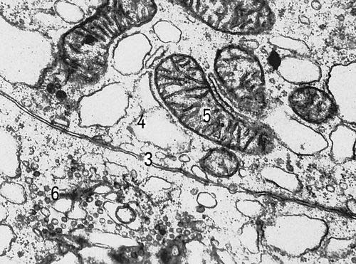 Участки двух клеток щитовидной железы крысы (увеличено в 30000 раз). Условные обозначения: 3 — клеточная оболочка, 4 — эндоплазматическая сеть, 5 — митохондрии, 6 — комплекс Гольджи.