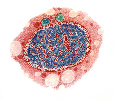 Клеточные ядра на окрашенных препаратах: полиплоидный макронуклеус и два микронуклеуса инфузории рода Nassula, окраска метиловым зеленым — пиронином: хроматин (фиолетовый) содержит и ДНК, и РНК, ядрышки (красные) — РНК, микронуклеусы зеленые.