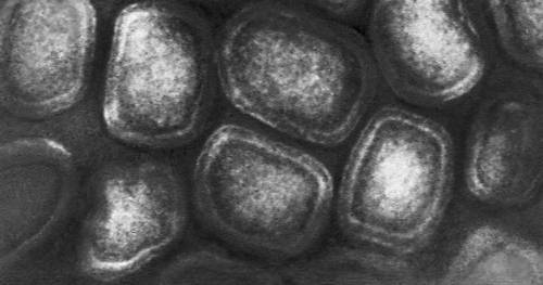 Различные типы вирионов под электронным микроскопом. Вирус осповакцины. Увеличено в 50 000 раз.