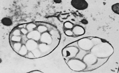 Рис. 2. Зёрна крахмала в развивающейся клетке эндосперма риса.