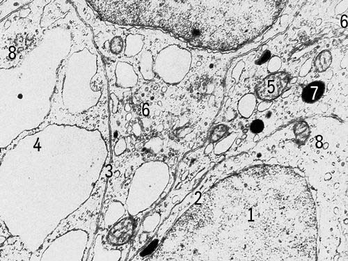 Клетки щитовидной железы крысы с включениями (увеличено в 18000 раз). Условные обозначения: 1 — ядро, 2 — ядерная оболочка, 3 — клеточная оболочка, 4 — эндоплазматическая сеть, 5 — митохондрии, 6 — комплекс Гольджи, 7 — плотные тела, 8 — рибосомы.