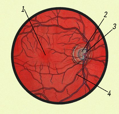 Глазное дно при осмотре офтальмоскопом: 1 — жёлтое пятно; 2 — диск зрительного нерва; 3 — вены сетчатки; 4 — артерии сетчатки.