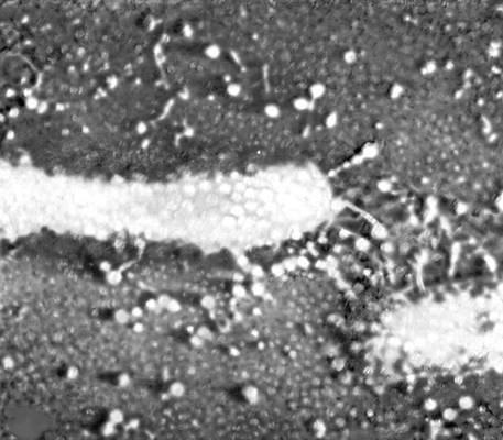 Электронная микрофотография кишечной палочки, окруженной частицами заражающего её фага Т2.