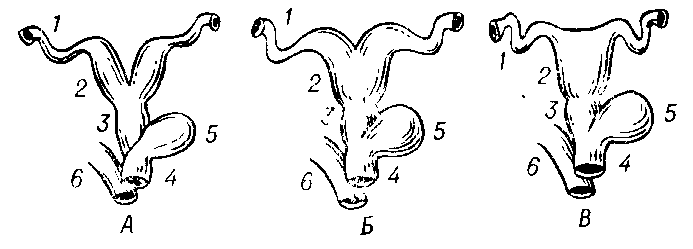 Различные типы строения матки у плацентарных млекопитающих: А — двойная; Б — двурогая; В — простая; 1 — яйцевод; 2 — матка; 3 — влагалище; 4 — мочеполовой синус; 5 — мочевой пузырь; 6 — прямая кишка.