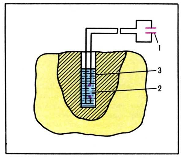 Pис. 4. Электрогидравлическое дробление негабарита: 1 - батарея конденсаторов; 2 - разрядный промежуток; 3 - <a href=