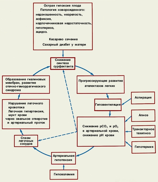 Схема патогенеза респираторного дистресс-синдрома новорожденных с образованием «порочного круга»
