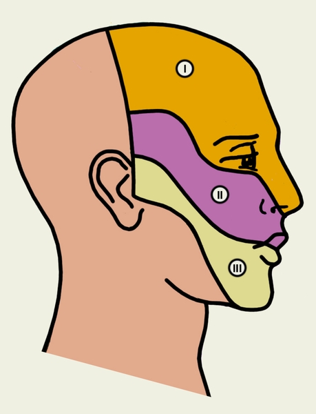 Рис. 3. Схематическое изображение зон иннервации кожи головы периферическими ветвями тройничного нерва: 1 — глазной нерв; 2 — верхнечелюстной нерв; 3 — нижнечелюстной нерв