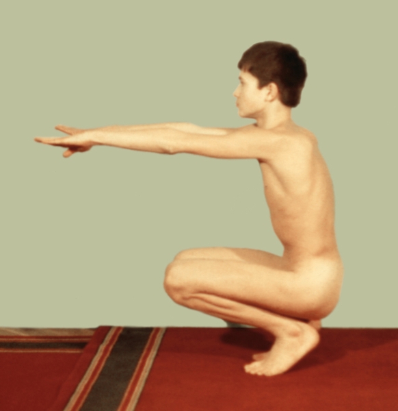 Рис. 3в). Исследование подвижности позвоночника и суставов нижних конечностей у мальчика 12 лет при экстензионно-бедренной ригидности (синдроме Фюрмайера): приседание — подвижность в коленных суставах не ограничена
