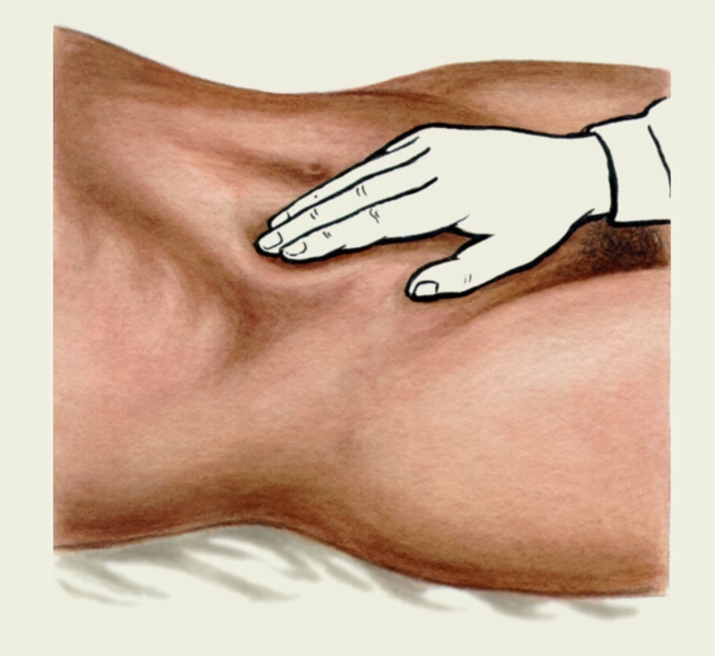 Рис. 5а). Положение рук исследующего при поверхностной ориентировочной пальпации живота