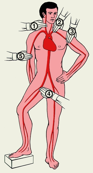 Схематическое изображение мест прижатия основных артерий на <a href=
