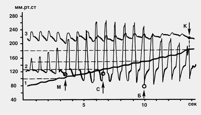 Комплекс основных кривых, записанных на механокардиографе Савицкого, для определения всех параметров артериального давления: 1 — кривая компрессионного давления в манжете, наложенной на плечо; 2 — тахоосциллограмма, кружками отмечены изменения кривой, соответствующие достижению в компрессионной манжете значений артериального давления — минимального (М), среднего (С) и бокового систолического (Б); 3 — <a href=