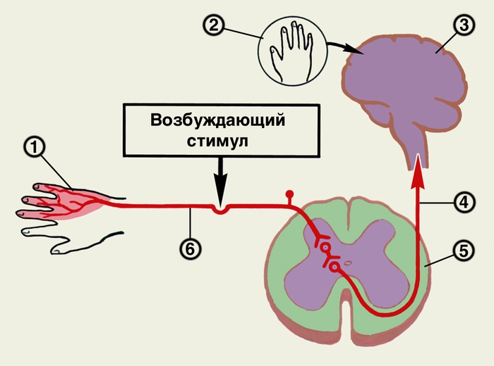Рис. 1. Схема возникновения проецируемой боли. Нервные импульсы, вызванные прямой стимуляцией (указано стрелкой), по афферентным волокнам в составе спиноталамического тракта доходят до соответствующей зоны коры головного мозга, вызывая ощущение боли в той части тела (руки), которая обычно вызывается раздражением нервных окончаний: 1 — часть тела с болевыми рецепторами; 2 — ощущение боли в месте расположения соответствующих рецепторов боли; 3 — <a href=