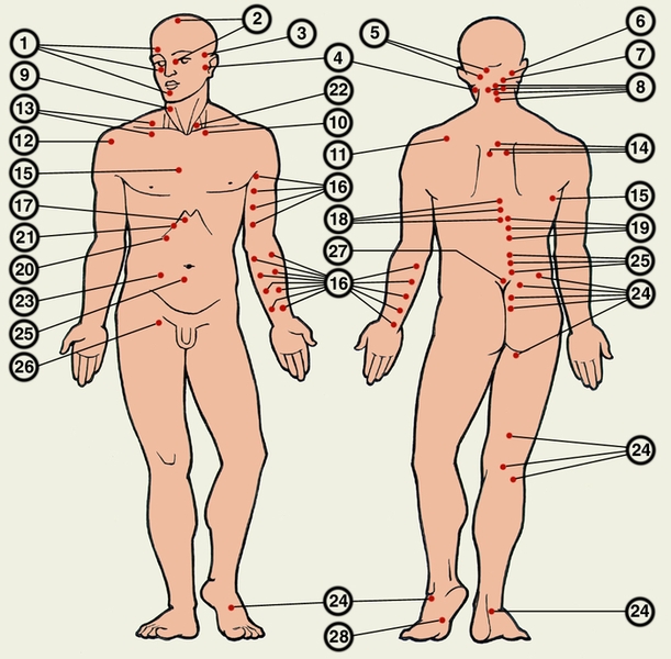 Некоторые болевые точки в области головы, туловища, конечностей: 1 — точки выхода ветвей тройничного нерва; 2 — сосудистые точки Гринштейна; 3 — точка поверхностной височной артерии; 4 — точки лицевого нерва; 5 — точки затылочных нервов; 6 — точка верхнего шейного узла; 7—точка позвоночной артерии; 8 — точки остистых отростков, паравертебральные точки шейного отдела позвоночника; 9 — точка грудино-ключично-сосцевидной мышцы; 10 — точка прикрепления передней лестничной мышцы: 11 — точка в области клювовидного отростка лопатки; 12 — точка плечевого сустава; 13 — точки Эрба; 14 — точки остистых отростков и паравертебральные точки грудного отдела позвоночника; 15 — точки межреберных нервов; 16 — точки сосудисто-нервного пучка и периферических нервов руки; 17 — точка солнечного сплетения; 18 — точки Опенховского; 19 — точки Боаса; 20 — точка желчного пузыря; 21 — точка Ортнера; 22 — точка Мюсси; 23 — точка Мак-Бернея; 24 — точки Балле; 25 — точки Хары; 26 — точка выхода на <a href=