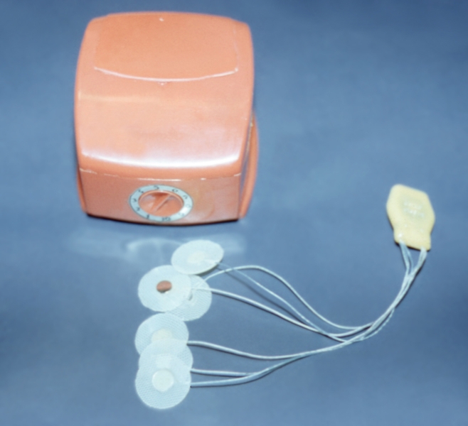 Рис. 1. Радиоимпульсный стимулятор мочевого пузыря, применяемый для реабилитации больных с нарушением функции мочеиспускания