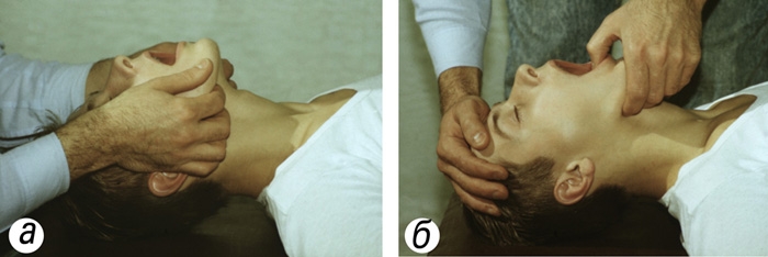 Рис. 1. Подготовка к проведению искусственного дыхания: выдвигают нижнюю челюсть вперед (а), затем переводят <a href=