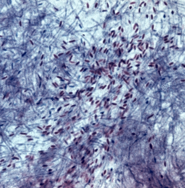 Рис. 8. Чистая культура Bacillus cereus: видны окрашенные в малиновый <a href=
