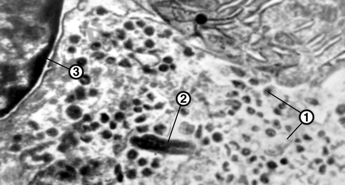 Рис. 4г). Электронограммы разных видов секреторных клеток панкреатических островков: РР-клетки (1 — гранулы, 2 — <a href=
