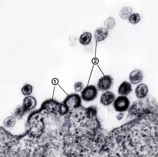 Рис. 5. Электронограмма почкующихся (1) и зрелых (2) частиц вируса иммунодефицита человека; × 100 000