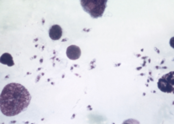 Рис. 1. Leishmania donovani, безжгутиковая форма, в мазке костного мозга; окраска по Романовскому — Гимзе
