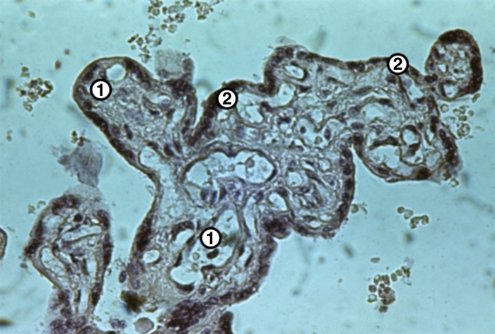 Рис. 5б). Микропрепарат участка плаценты с компенсаторно-приспособительными изменениями при доношенной беременности: гиперплазия капилляров и синцитиокапиллярные мембраны в концевой ворсине (1 — расширенные капилляры, 2 — синцитиокапиллярные мембраны); окраска гематоксилином и эозином; ×250