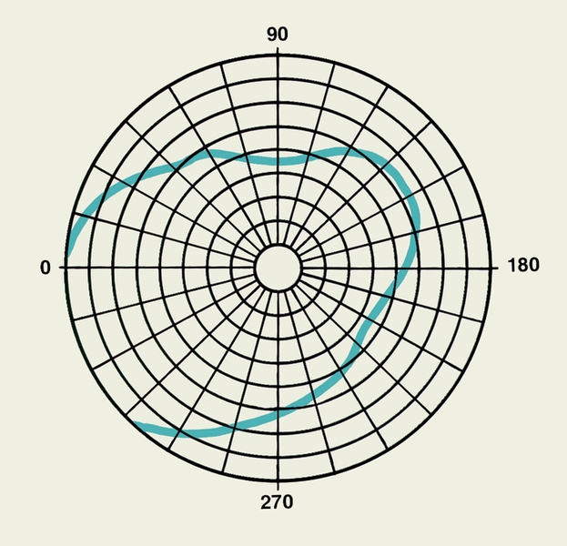 Рис. 2а). Схема нормальных полей зрения (пространство, воспринимаемое глазом при неподвижном взгляде — на рисунке голубая <a href=
