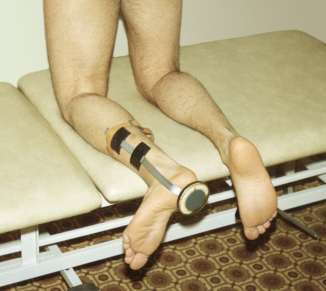 Рис. 9б). Измерение амплитуды движений в коленном суставе: ротация голени, измерение с помощью ротатометра