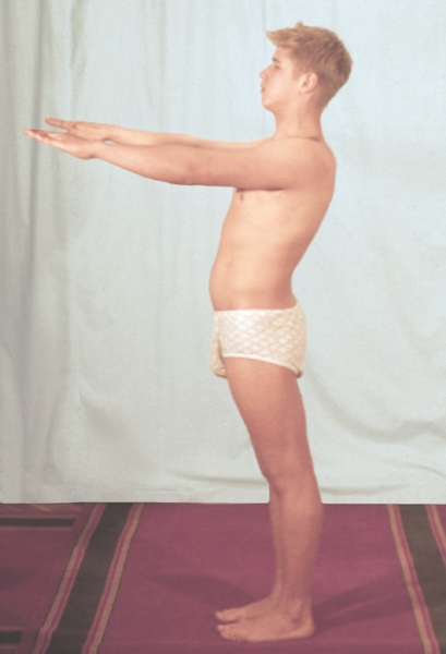 Рис. 4а). Круглая спина у подростка 15 лет: при исследовании околопозвоночных мышц с поднятыми вперед руками выпрямление позвоночника невозможно