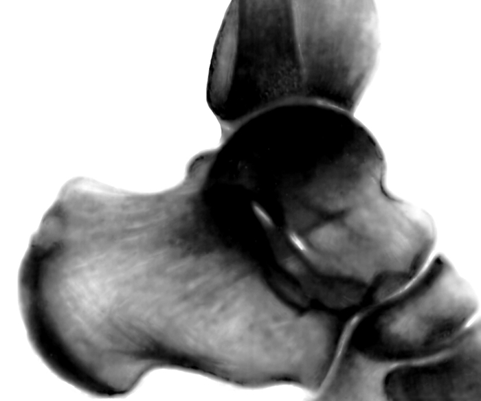Рис. 2в). Рентгенограммы голеностопного сустава в норме: добавочная косточка внутренней лодыжки (указана стрелкой)