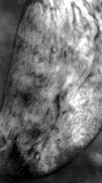 Рис. а). Рентгенологическая картина рельефа слизистой оболочки желудка при двойном контрастировании: мелкосетчатый тип рельефа