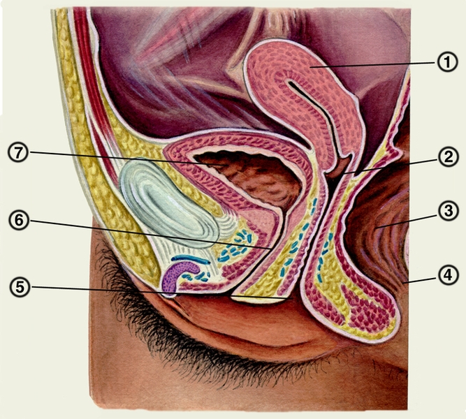 Рис. 1. Схематическое изображение сагиттального разреза малого таза женщины: 1 — матка; 2 — влагалище; 3 — <a href=
