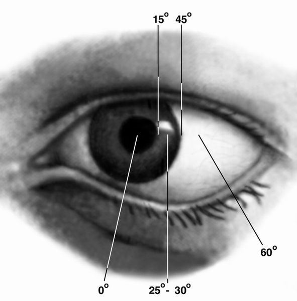 Рис. 3. Схематическое изображение глаза при измерении угла косоглазия по методу Гиршберга: при локализации светового рефлекса от зеркального офтальмоскопа на краю зрачка угол косоглазия равен 15°; локализация светового рефлекса на середине радужки соответствует углу косоглазия, равному 25—30°, в области лимба — 45°, за лимбом — 60° и выше