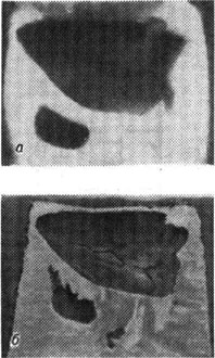 К ст. Дефектоскопия. Снимок в гамма-излучении (а) и фотография разреза прибыли (б) слитка массой около 500 кг; видна усадочная раковина