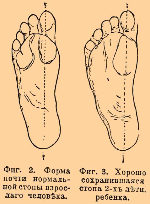 Фиг. 2. Форма почти нормальной стопы взрослого человека.