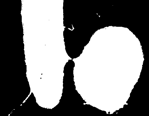 Рис. 2. Электронномикроскопическое изображение конъюгации у кишечной палочки; удлинённая клетка — донор, круглая — реципиент.