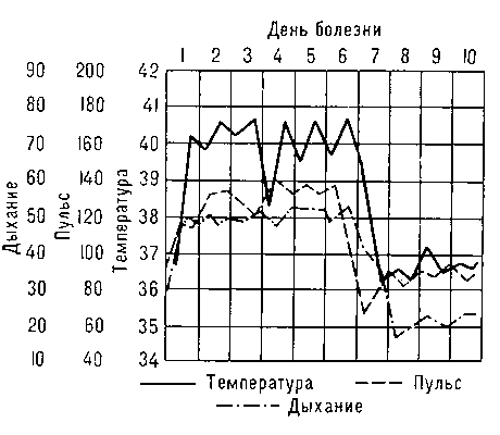 Температурная кривая (постоянного типа) при крупозной пневмонии.