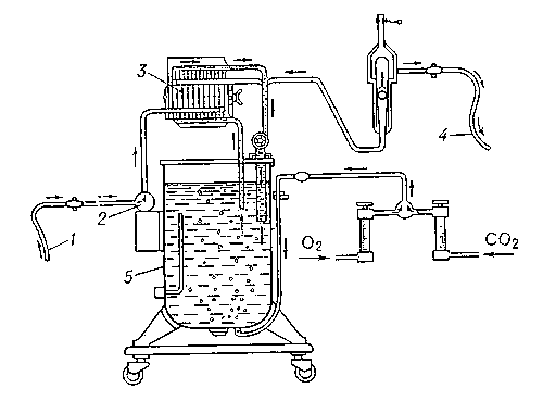 Схема советской модели аппарата «искусственная почка»: 1 — катетер; 2 — насос; 3 — диализатор; 4 — катетер возврата крови больному; 5 — бак для диализирующего раствора.