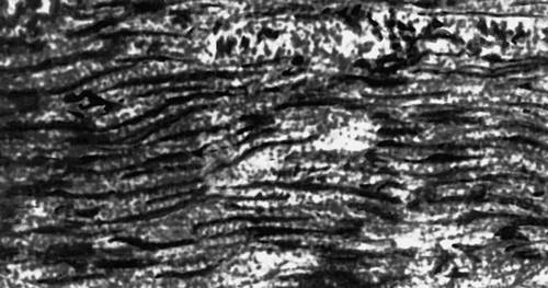 Рис. 4. Электронная микрофотография гладкомышечного волокна. Видны актиновые нити (показаны стрелками).