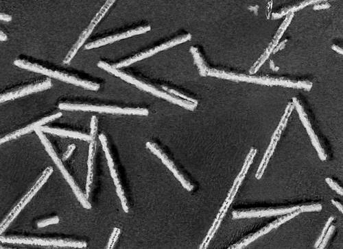 Различные типы вирионов под электронным микроскопом. Вирус мозаичной болезни табака. Увеличено в 50 000 раз.