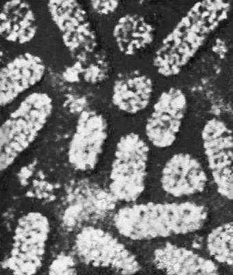 Различные типы вирионов под электронным микроскопом. Вирус мозаичной болезни люцерны.