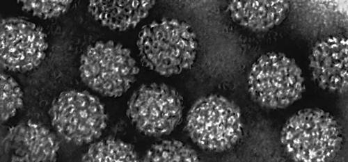 Рис. 4. Cферический вирус (электронно-микроскопический снимок, увеличено).