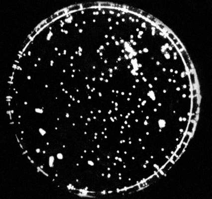 Биолюминесценция. Культура светящихся бактерий в их собственном свете.