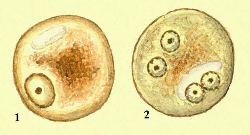 Дизентирийная амеба (Entamoeba histolycia); 1 — вегетативная одноядерная форма; 2— четырехядерная циста.