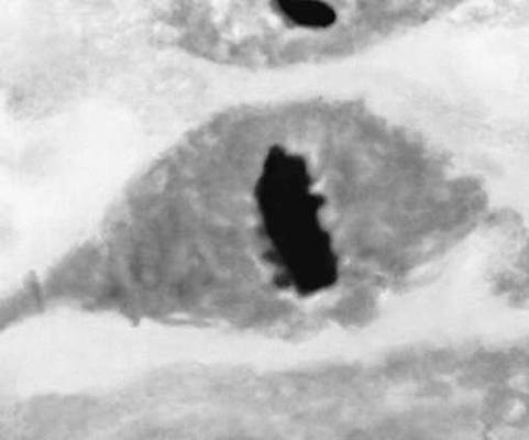 Делящаяся клетка культуры ткани одной из зародышевых оболочек (амниона) человека на стадии метафазы: фигура экваториальной пластинки (вид в плоскости экватора).