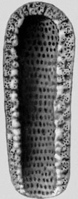 Рис. 1б — известковый панцирь водоросли Dactylopora из эоцена Парижского бассейна.